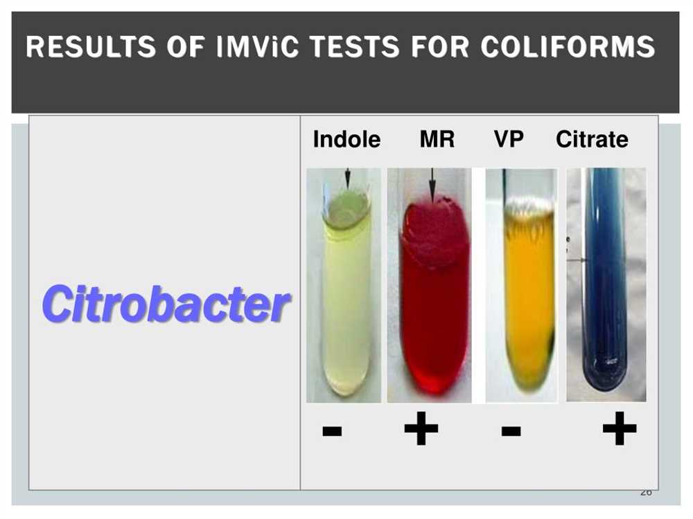 The Importance Of The Citrobacter Freundii Citrate Test In