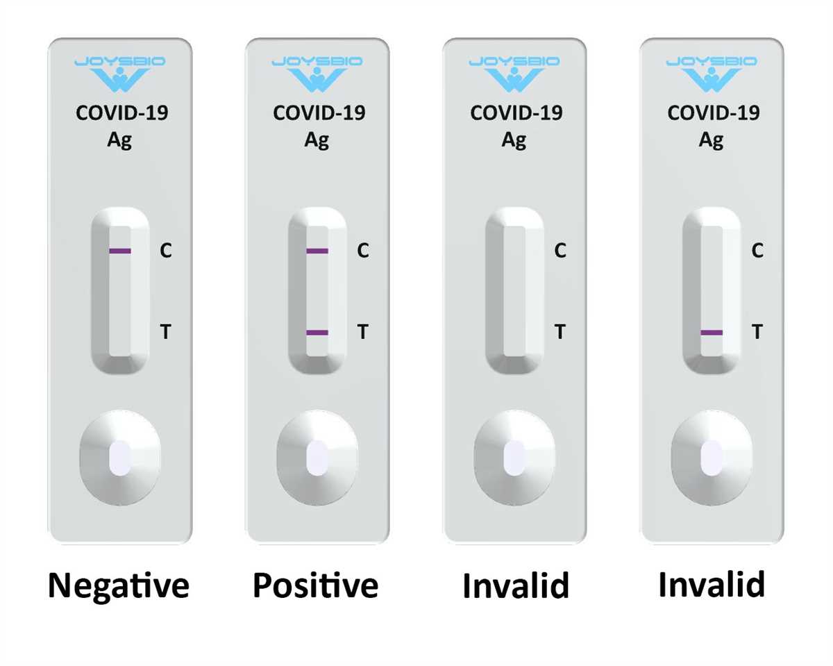 Overview of Lbr Test