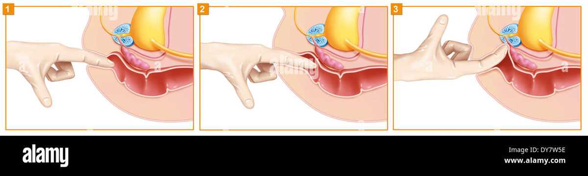 Guidelines for Conducting Safe and Pleasurable Erotic Prostate Exams