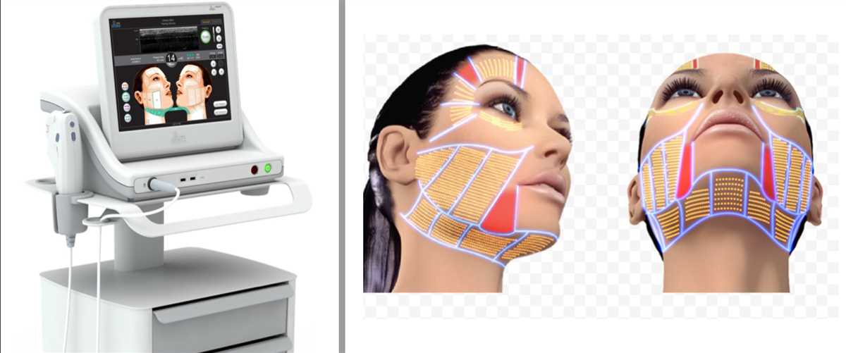 The Smas test is a valuable tool in facial aesthetic medicine as it allows for a more precise and personalized approach to treatment planning. By assessing the quality and strength of the SMAS, healthcare providers can better tailor their interventions to address the specific needs and concerns of each patient. This can lead to more successful outcomes and higher patient satisfaction.