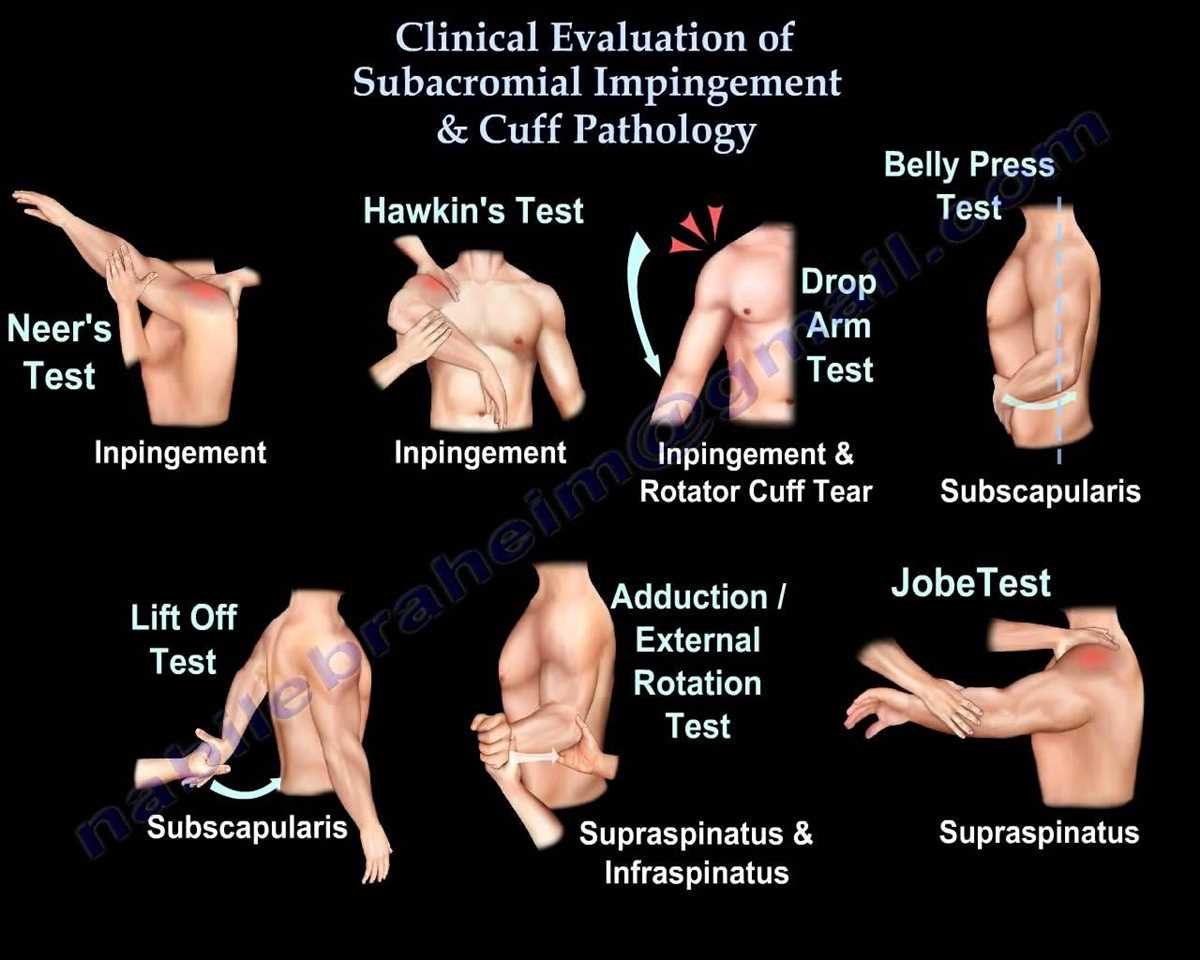 An Overview of Common Approaches