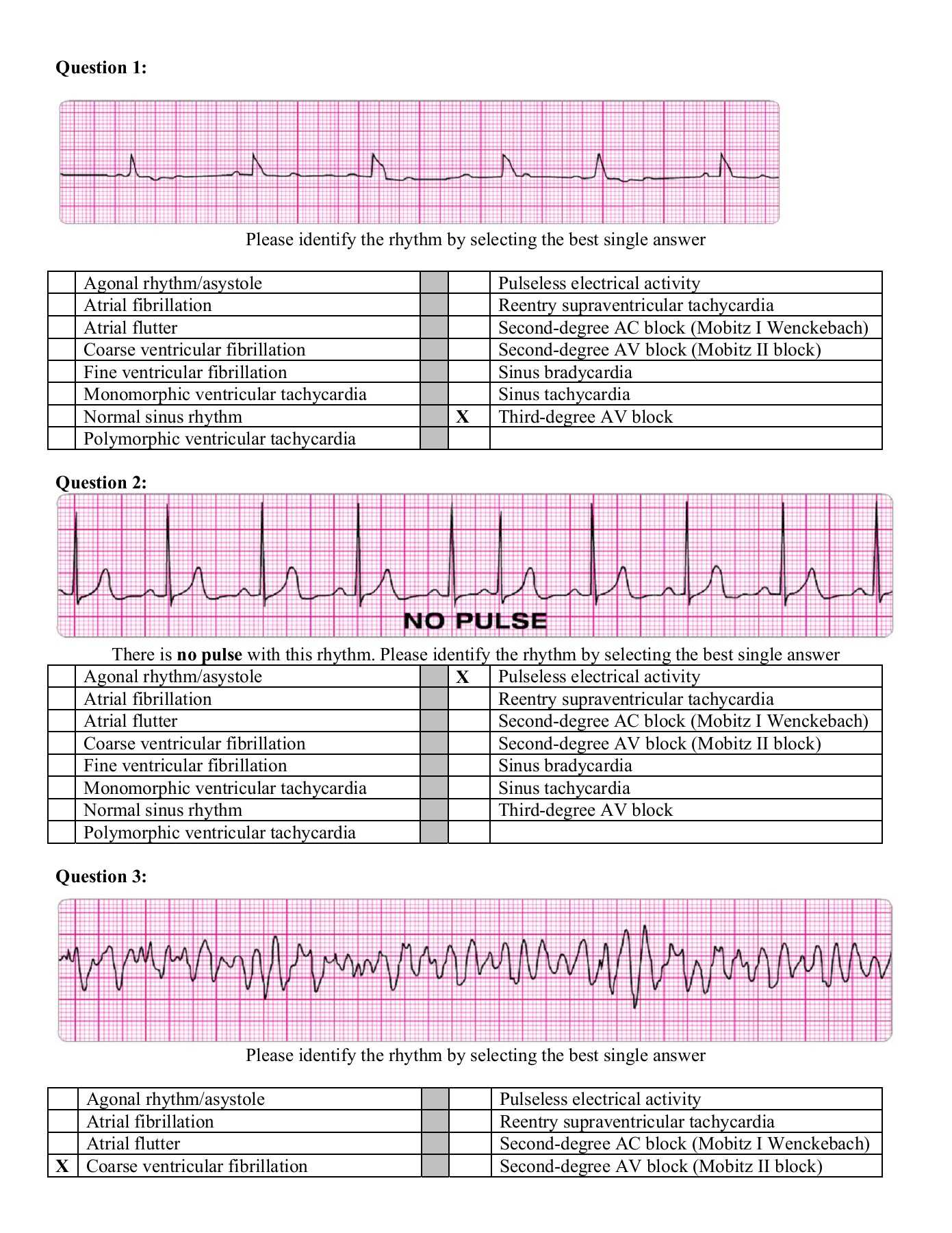 Acls practice test answers