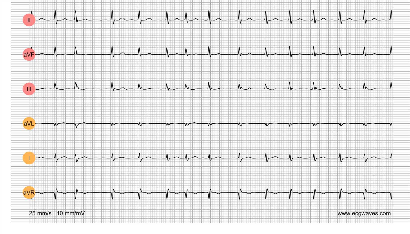 Why Simulated Challenges Are Crucial for Cardiological Mastery