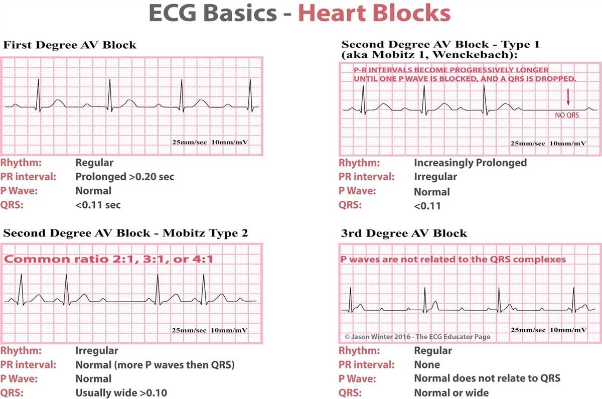 Analyzing the heart with ekg lab answers