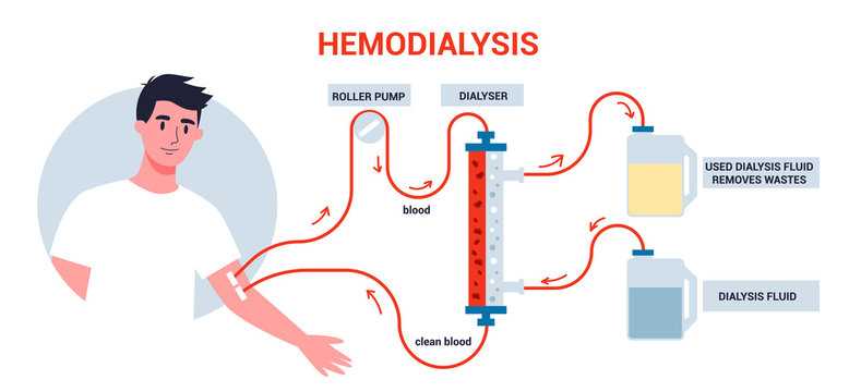 Dialysis exam questions and answers