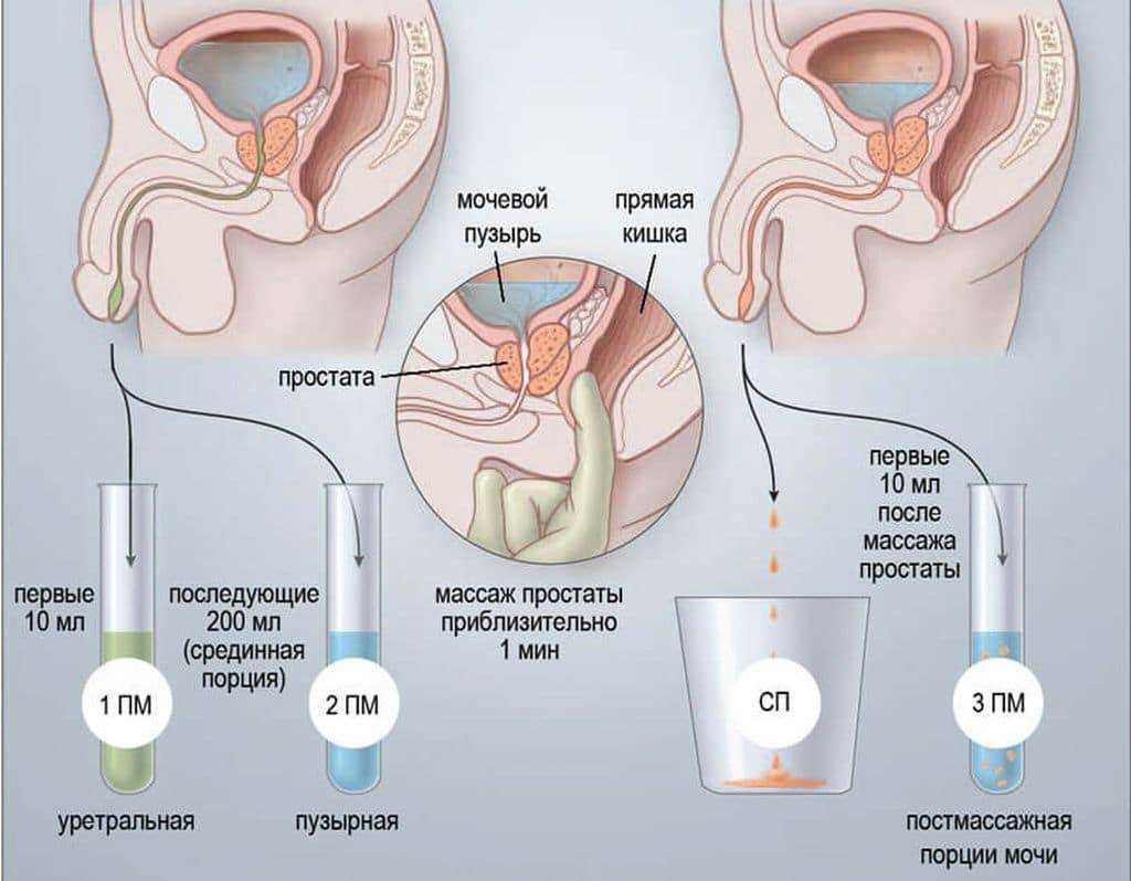 Erotic prostate exam stories