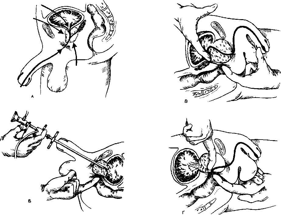 5. Gradual Stimulation: