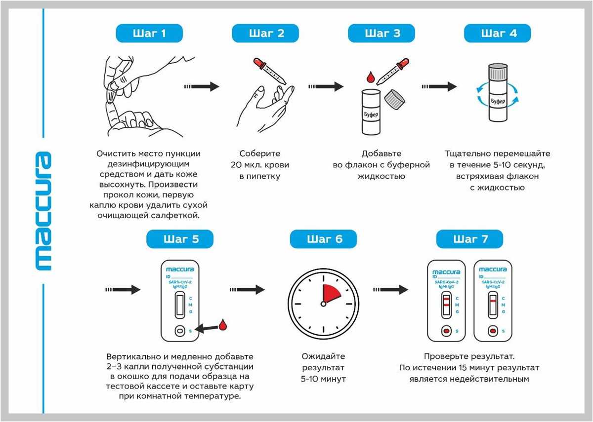 What to Expect During an Lbr Test