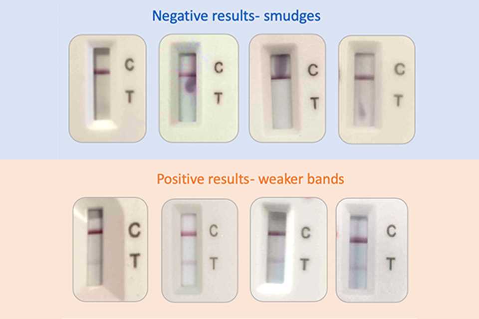 Interpreting Lbr Test Results