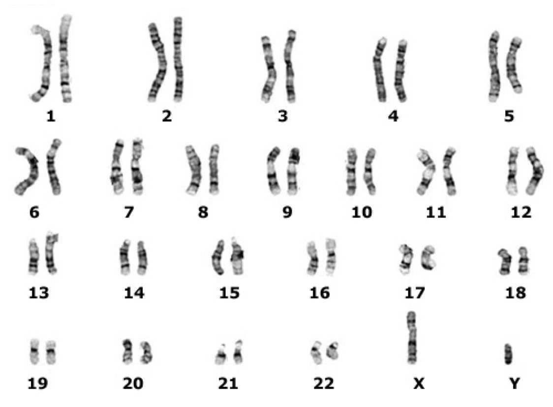 Identification and Classification of Human Chromosomes