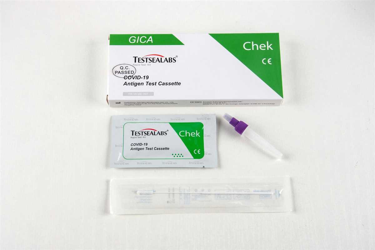 Furthermore, Toberman's Covid testing services prioritize accessibility and convenience. With multiple testing locations across the region, individuals can easily find a testing site near them, minimizing travel and wait times. The streamlined process implemented by Toberman allows for efficient testing, ensuring that results are delivered promptly, enabling individuals to take appropriate actions to protect themselves and others.