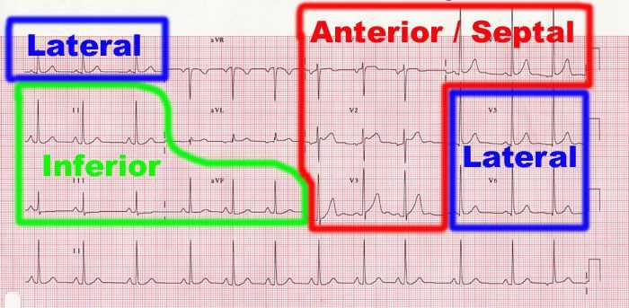 The Importance of EKG Lab Answers