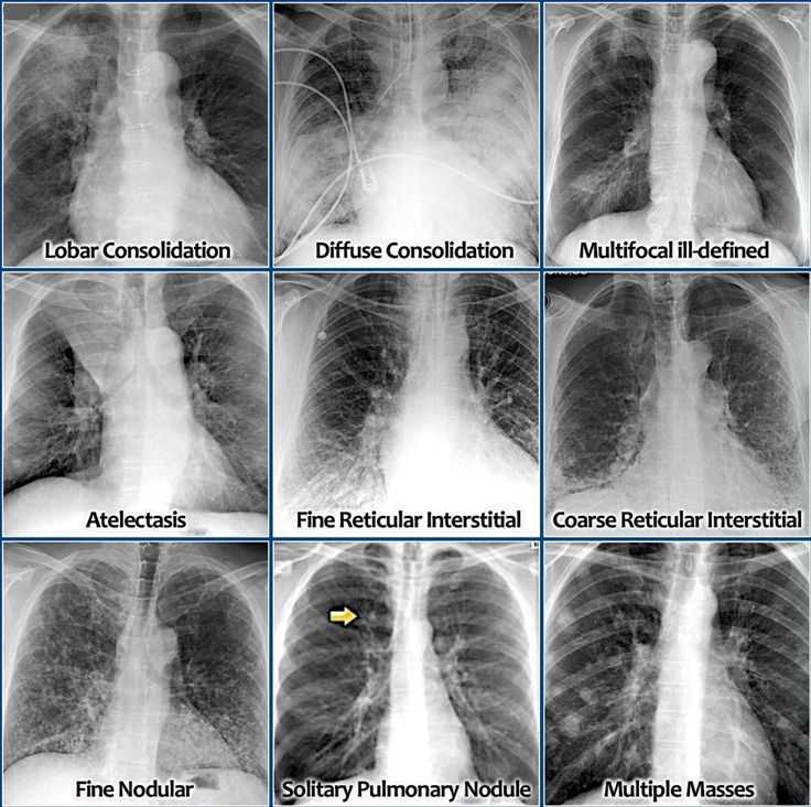 Identifying x rays haspi 08d answers