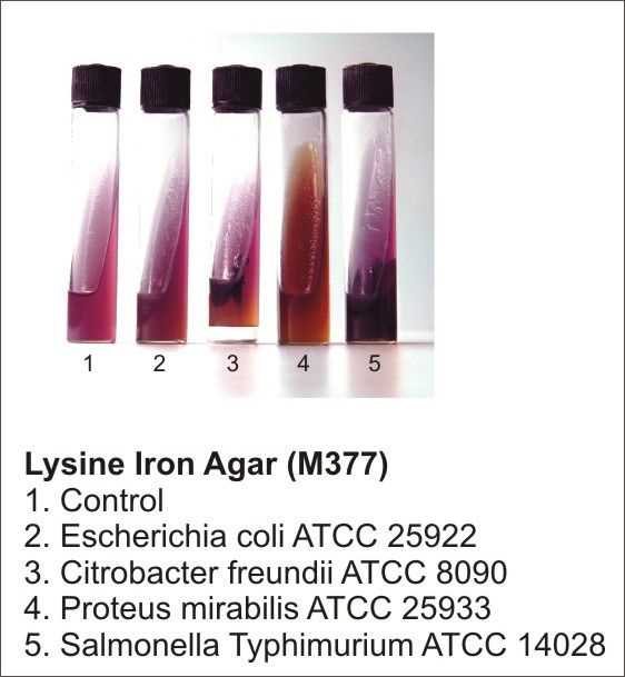 Citrobacter freundii and its antibiotic resistance