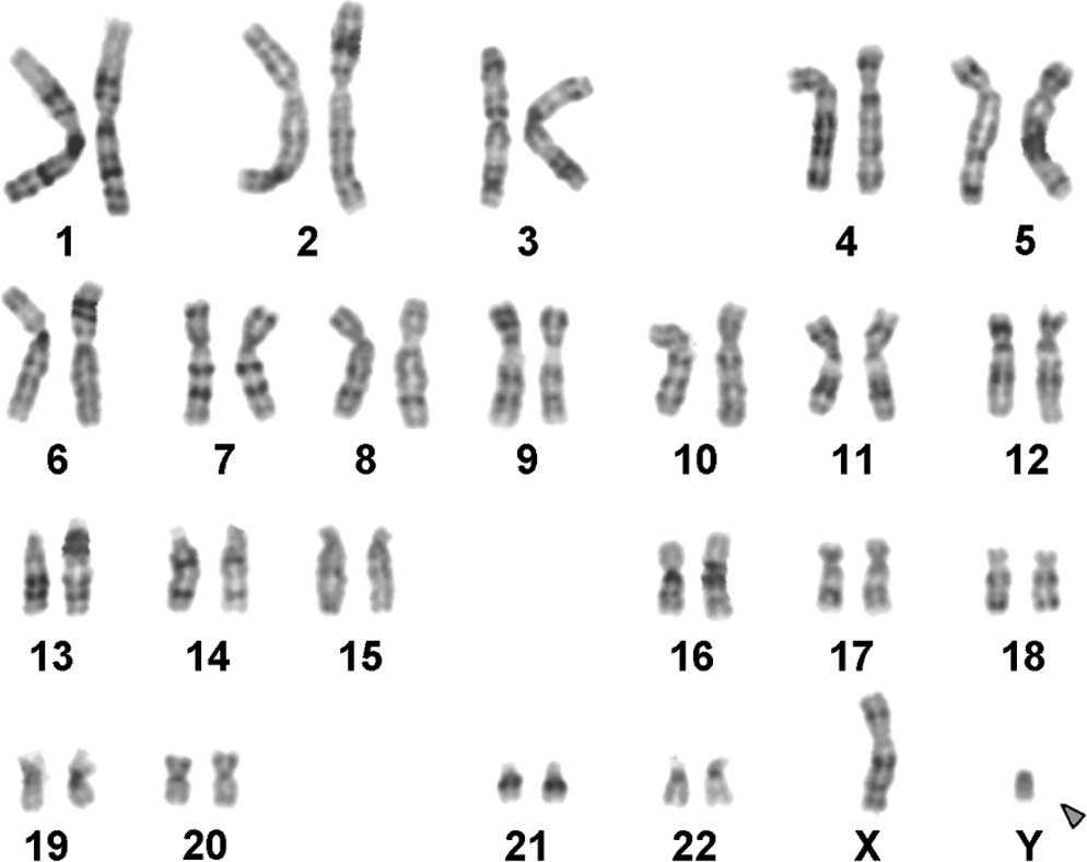 Chromosomes 101