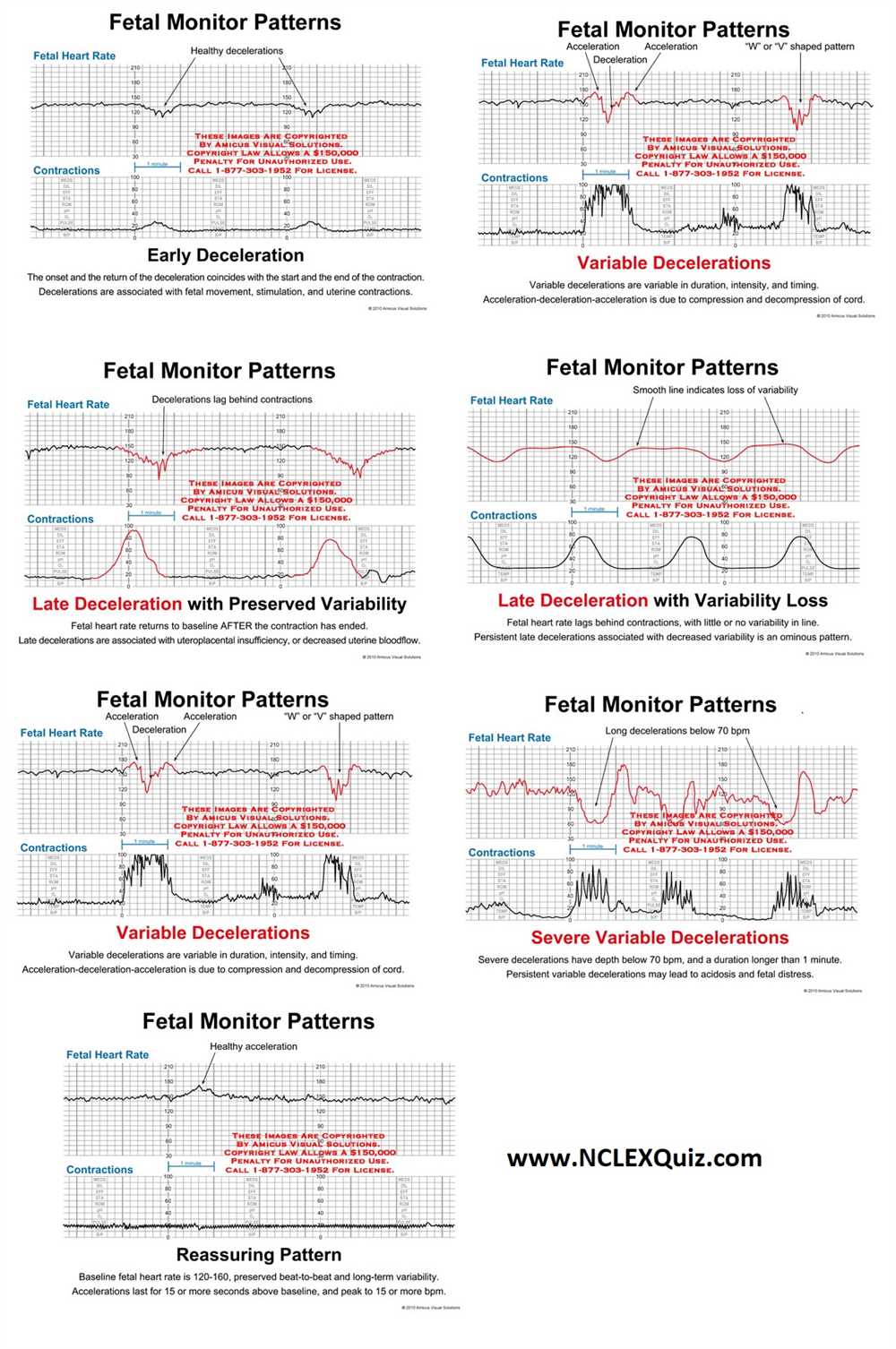 Relias fetal heart monitoring answers