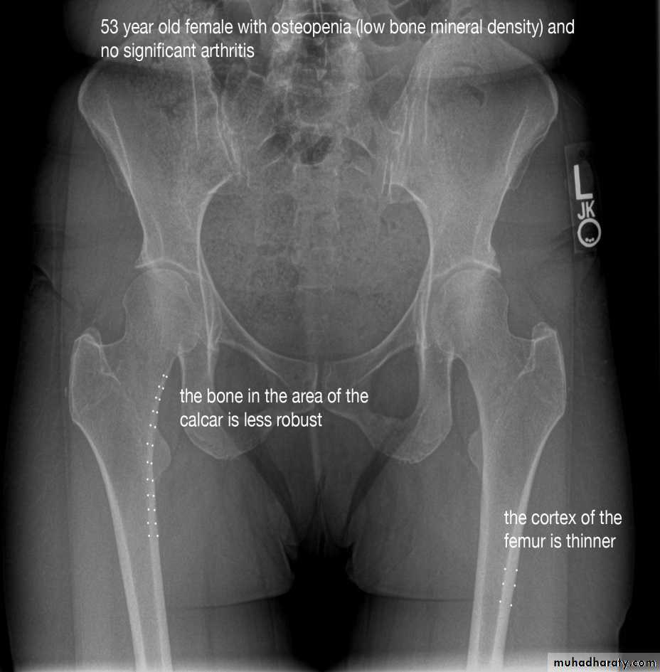 How do x-rays work?