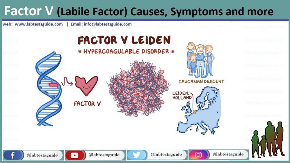 V Factor Test Procedure