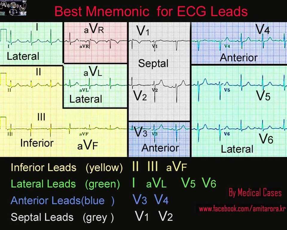 Analyzing the heart with ekg lab quest 12 answers