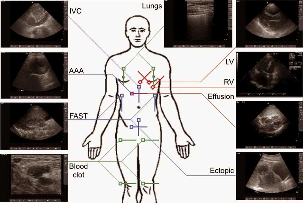 Cna acute care exam