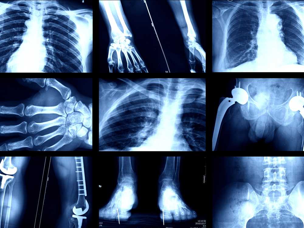 Disadvantages of x-ray imaging technology: