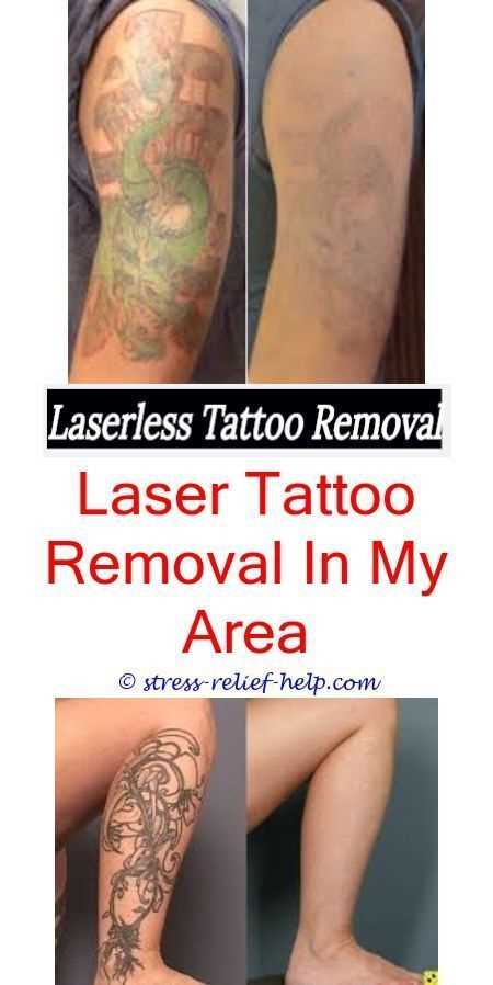 Decoding Eraser Tattoo CommonLit answers: Unveiling the Key Insights