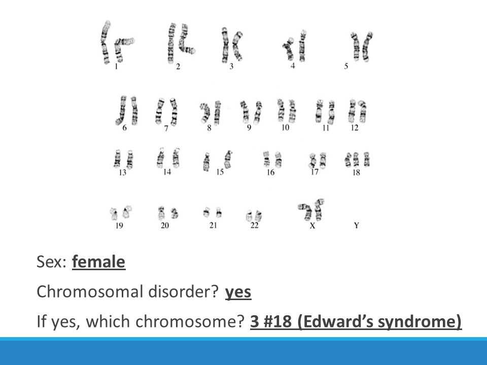 Karyotype webquest answer key