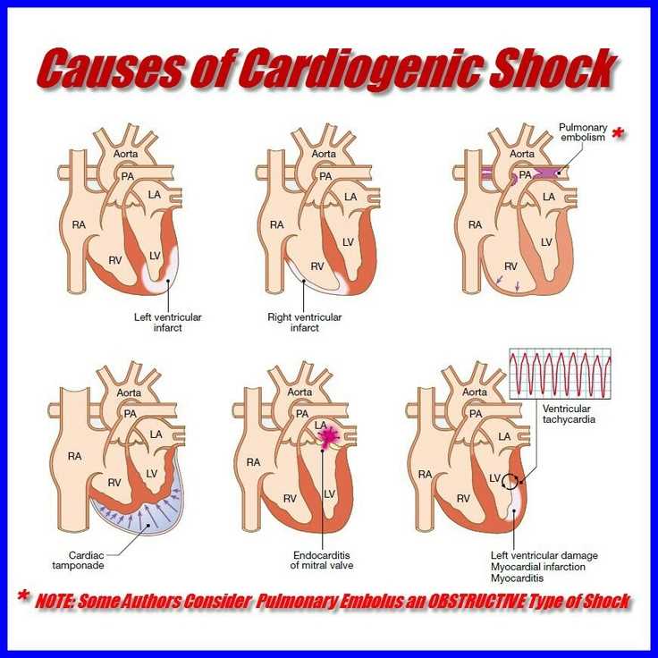 Paramedic cardiology practice test