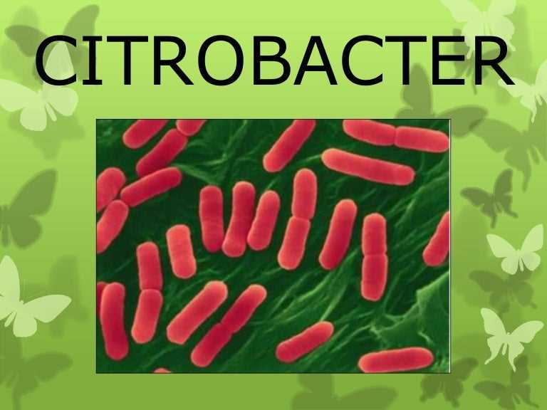 Virulence factors associated with Citrobacter freundii