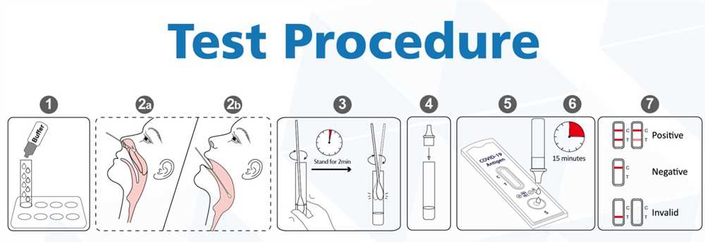 Slosson Test