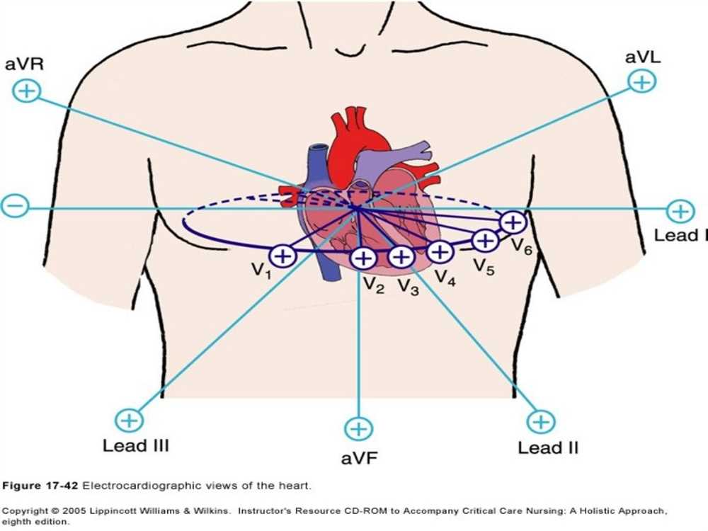 Analyzing the Heart's Electrical Activity with Lab Quest 12