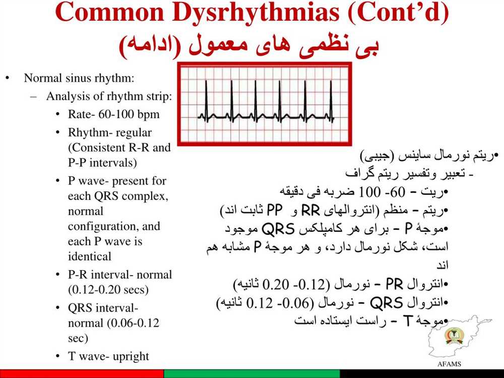 Prophecy dysrhythmia advanced test