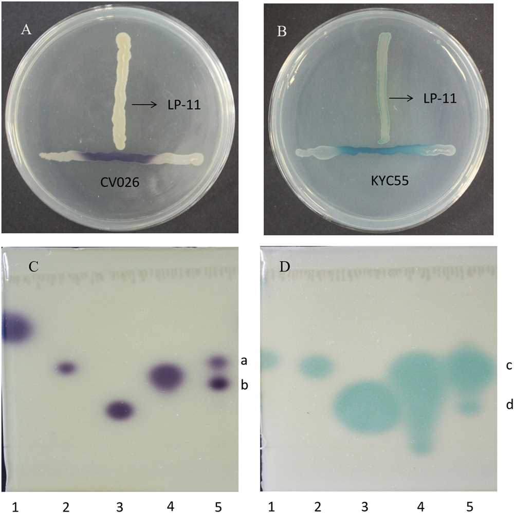 The citrate test is a biochemical test used to determine whether an organism can utilize citrate as a sole source of carbon and energy. In the case of Citrobacter freundii, this test can be particularly useful in differentiating it from other bacteria that may be present in clinical samples.