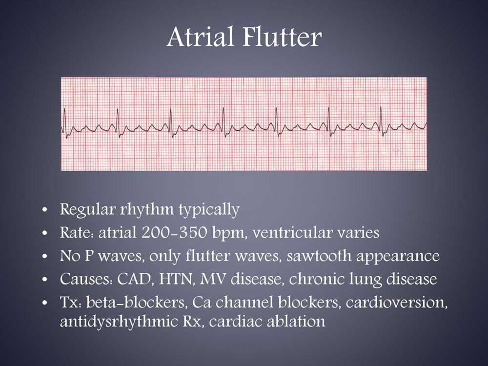 Defibrillator