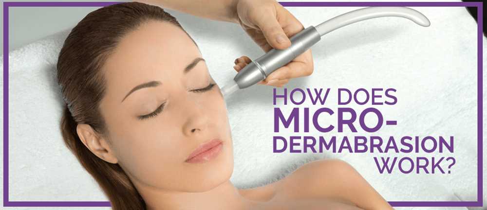 Test the microdermabrasion level on