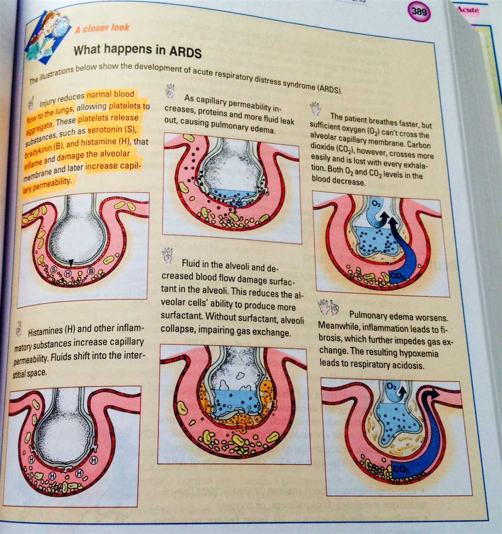 Gastrointestinal System Disorders